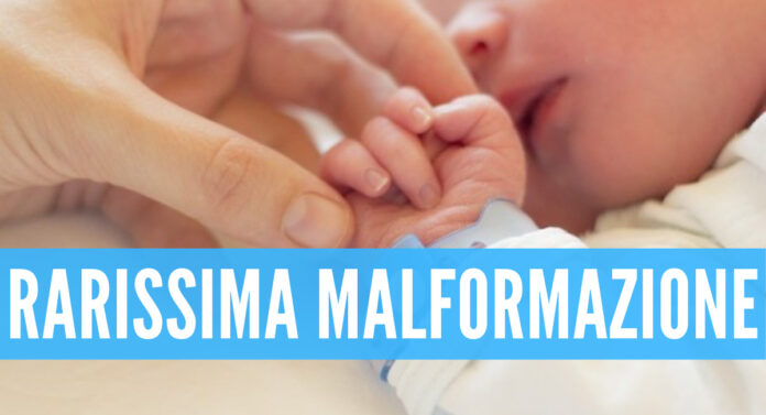 Bimbo con tre peni in Iraq