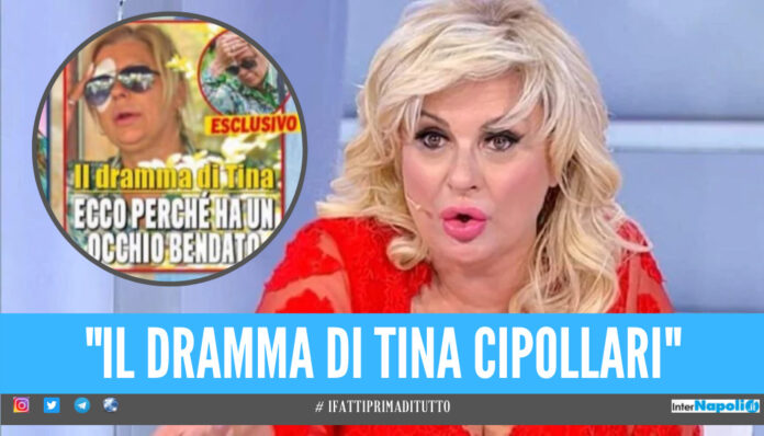 Tina Cipollari in ospedale, incidente per la star di 'Uomini e Donne': «Olio bollente sull'occhio»