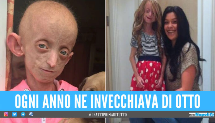 Aveva il corpo di una donna di 144 anni, 18enne uccisa dalla sindrome di Hutchinson-Gilford