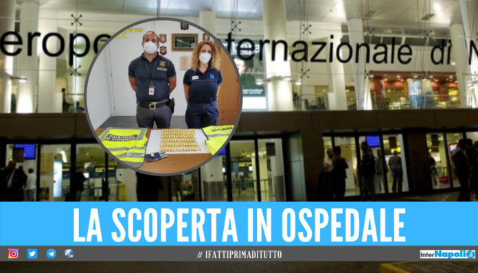 Narcos arrestato a Capodichino, trasportava 87 ovuli di cocaina nell'addome