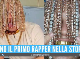 Catene d’oro e diamanti impiantati al posto dei capelli, la follia del rapper Dan Sur