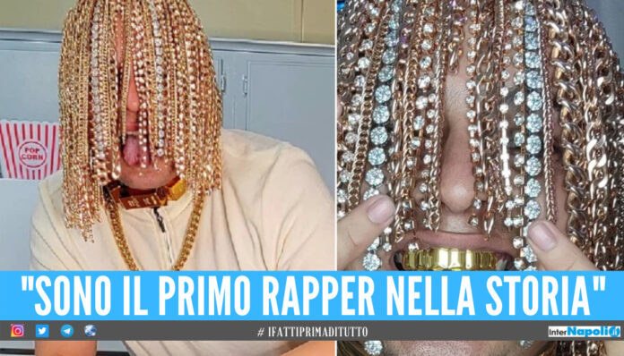 Catene d’oro e diamanti impiantati al posto dei capelli, la follia del rapper Dan Sur
