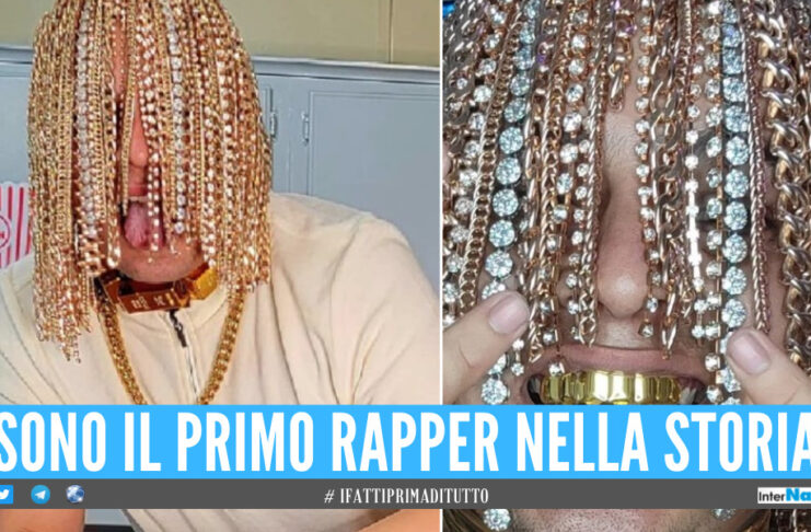 Catene d’oro e diamanti impiantati al posto dei capelli, la follia del rapper Dan Sur