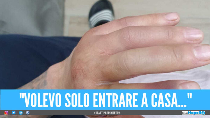 Lite in strada finisce nel sangue nel Napoletano, giovane sparato alla mano: chiesti 12 anni di carcere