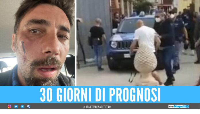 Vittorio Brumotti aggredito a San Severo
