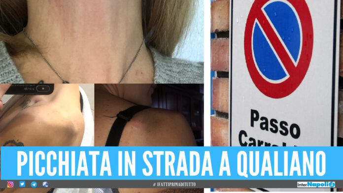 Violenta aggressione a Qualiano, donna picchiata e insultata mentre fa manovra con l'auto