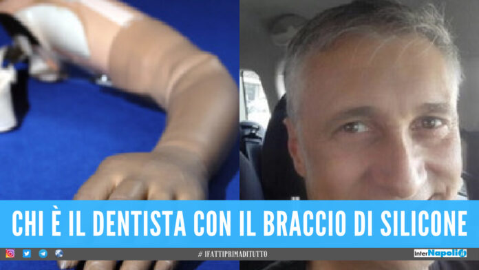 É un dentista l'uomo che voleva vaccinarsi con il braccio di silicone, la protesi comprata online
