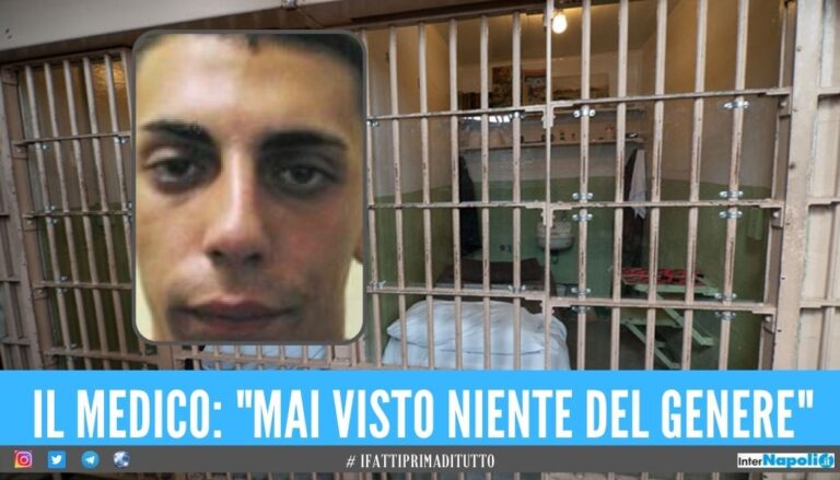 Antonio Raddi muore in carcere dopo aver perso 25 kg, inchiesta sul detenuto
