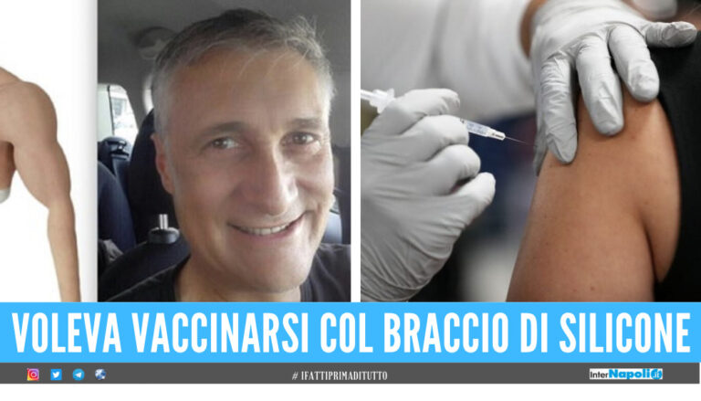 Lo sfogo del dentista no vax col braccio di silicone: “Mi avete rovinato la vita”