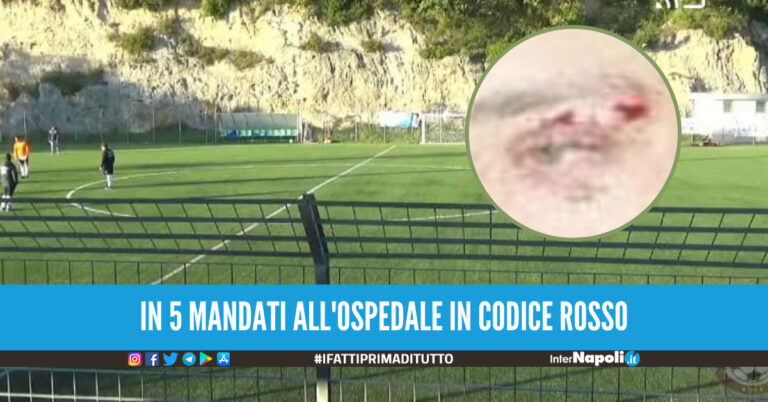 Partita di calcio finisce nel sangue a Salerno, calciatori e dirigenti picchiati dopo la vittoria