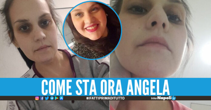 angela iannotta