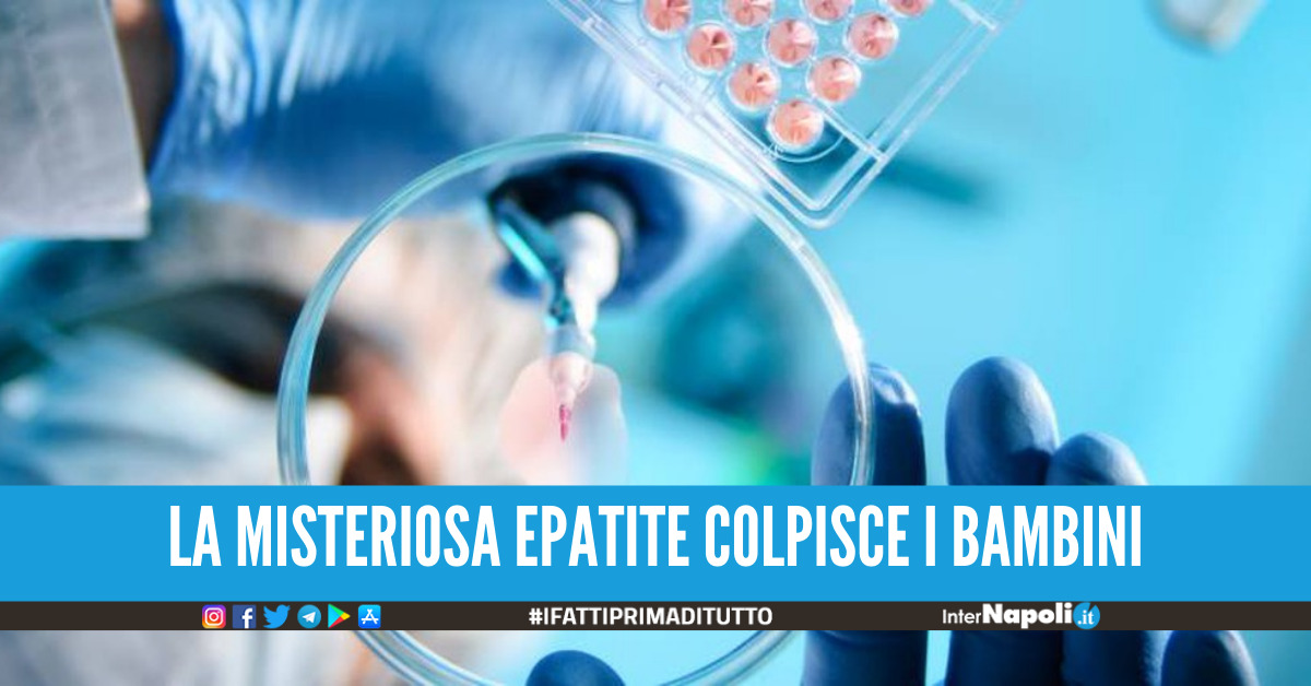 Epatite acuta, primo caso anche a Milano: bimbo di 4 anni in ospedale