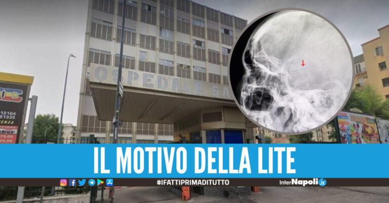 Ragazzino infilzato alla testa con una chiave, l'aggressione dopo una lite sul campo di calcetto
