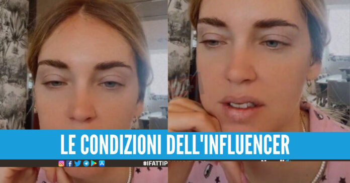 Periodo nero per i 'Ferragnez', Chiara Ferragni non sta bene: 
