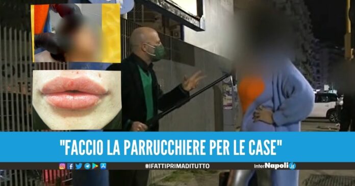 Parrucchiera di Napoli pubblicizzava lifting con silicone, botox e fili beccata da Luca Abete