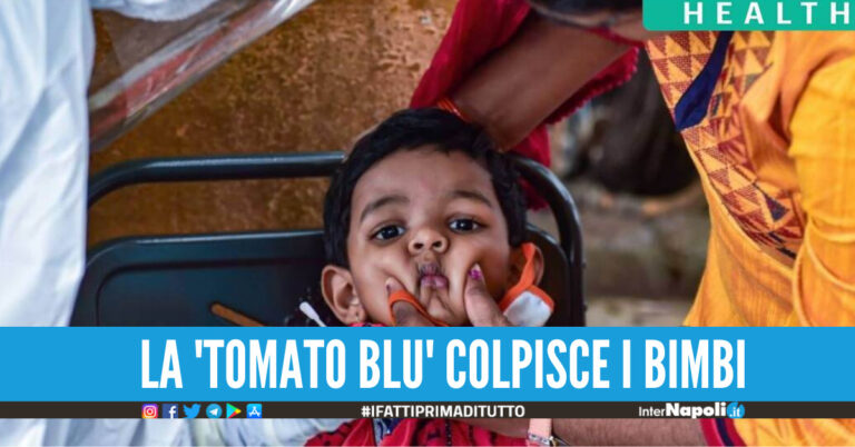 Allarme per l'influenza del pomodoro”, già 80 casi accertati tra cui molti bambini