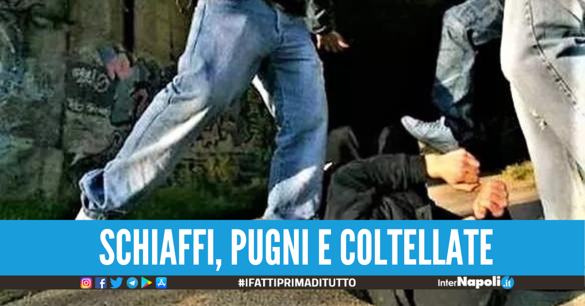 Rissa tra ragazzi in provincia di Napoli finisce a coltellate, 4 denunciati per lesioni e porto abusivo di armi