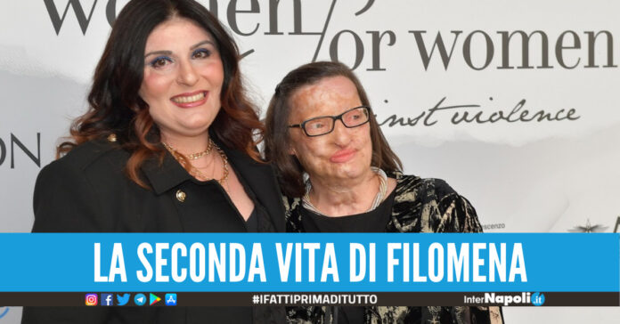Sfregiata con acido da ex, la rinascita della salernitana Filomena Lamberti