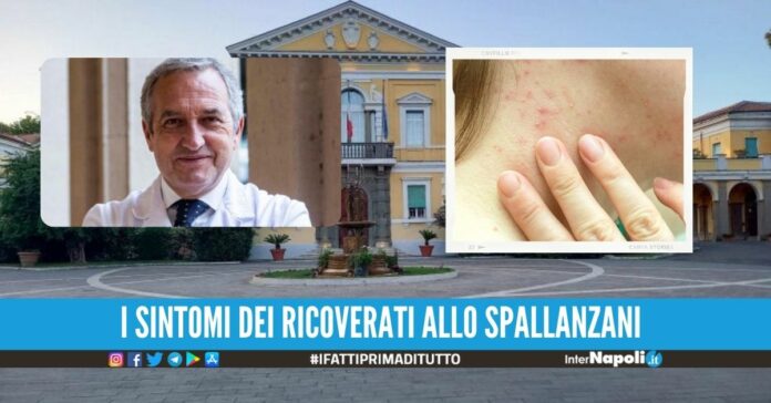 Vaiolo delle scimmie, 3 casi in Italia. Gli esperti dello Spallanzani La trasmissione tra uomini avviene così