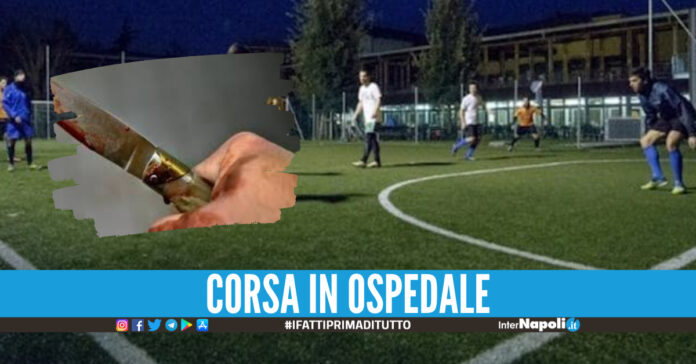 Lite sul campo di calcetto a Napoli, 13enne colpito dalla coltellata.  Stanotte i carabinieri della compagnia centro sono intervenuti presso