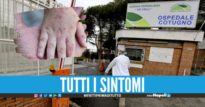 Ospedale Cotugno di Napoli, foto di repertorio