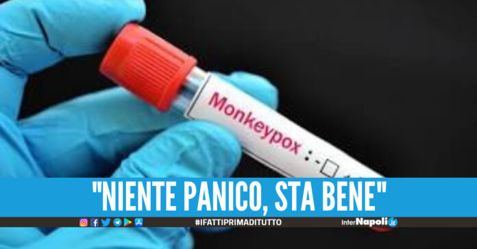 vaiolo delle scimmie