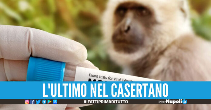 Vaiolo delle scimmie