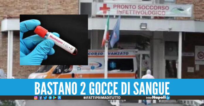 vaiolo delle scimmie