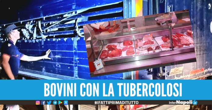 tubercolosi