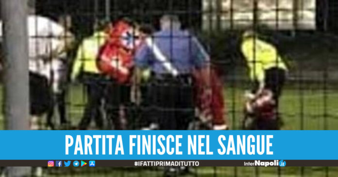 Napoli, lite durante la partita di calcetto due accoltellati