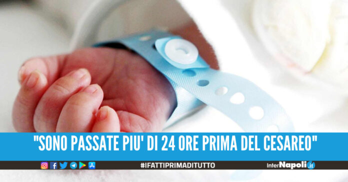 Parto cesareo