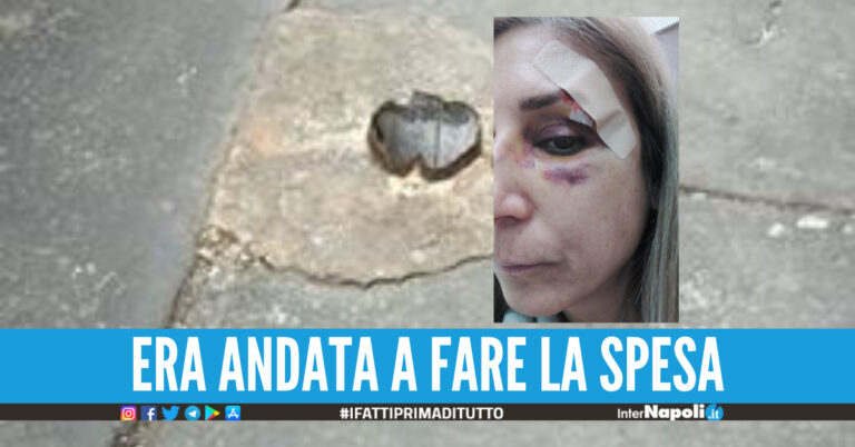 Napoli, donna inciampa a causa del manto stradale dissestato: volto tumefatto e punti di sutura