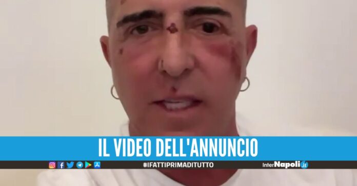franco ricciardi incidente