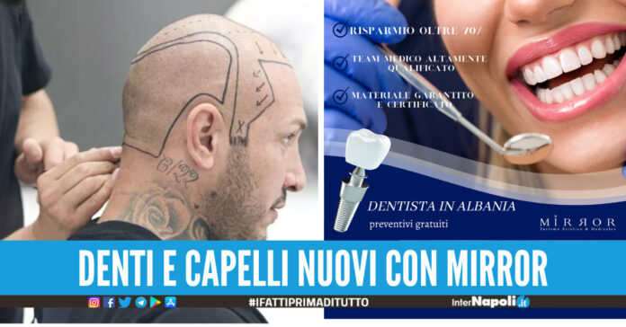 Trapianto di capelli e cura dei denti qualità, alta professionalità e convenienza con 'Mirror'