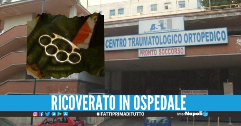 I Carabinieri del nucleo radiomobile di Napoli sono intervenuti nel pronto soccorso dell’ospedale Cto per un minorenne ferito.
