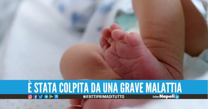 Riceve un farmaco da 2 milioni di euro, neonata lotta per la vita al Santobono