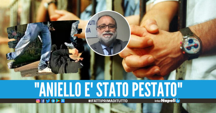 Arrestato per un residuo di pena, detenuto finisce in ospedale al Cardarelli Lo hanno picchiato, sia fatta chiarezza