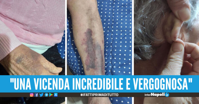 anziana picchiata a marigliano