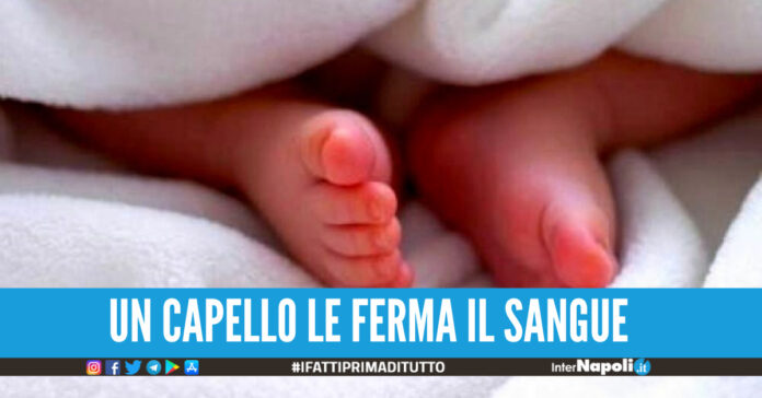 Un capello legato al dito del piede blocca la circolazione ad una bimba di 9 mesi.