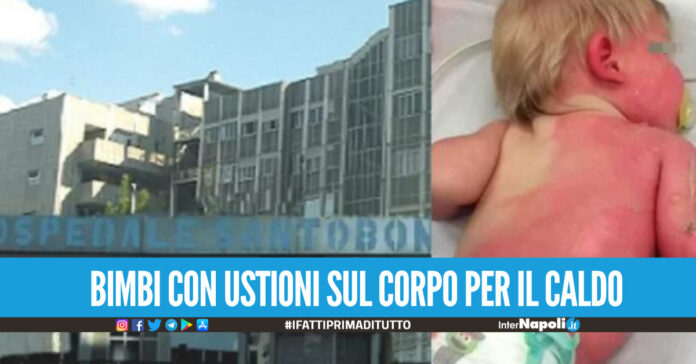 Emergenza caldo, record di accessi anche al Santobono bimbi con ustioni ed eritemi