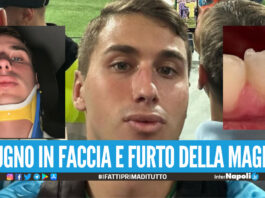 Tifoso del Napoli aggredito dopo la partita col Frosinone Sputi e pugno in faccia