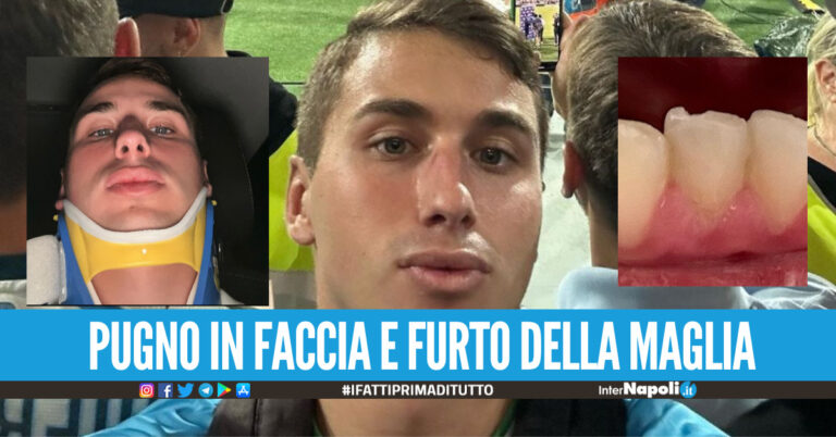 Tifoso del Napoli aggredito dopo la partita col Frosinone Sputi e pugno in faccia