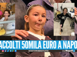 Concerto di beneficenza a Napoli per la piccola Angela, alla bimba amputata una gamba dopo un grave incidente