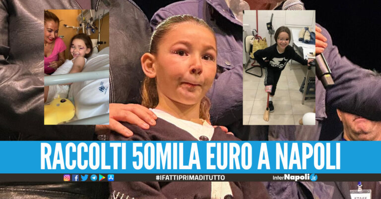 Concerto di beneficenza a Napoli per la piccola Angela, alla bimba amputata una gamba dopo un grave incidente
