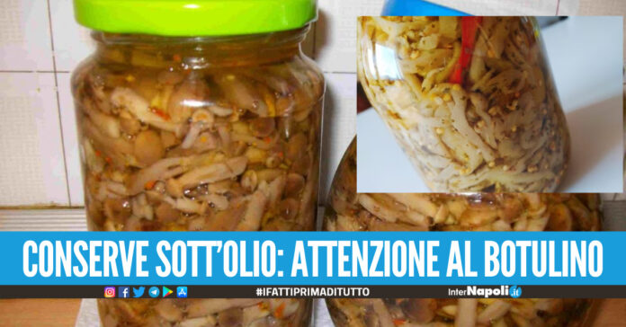 Cos'è il botulino, l'intossicazione può essere fatale: attenzione alle conserve sott'olio
