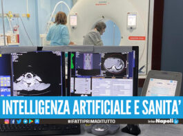 Ospedale Cardarelli, l’Intelligenza Artificiale aiuta i medici a valutare se operare il tumore al pancreas