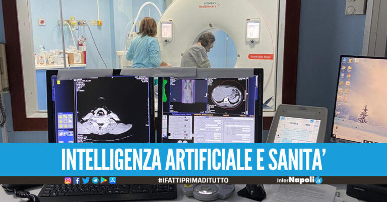 Ospedale Cardarelli, l’Intelligenza Artificiale aiuta i medici a valutare se operare il tumore al pancreas