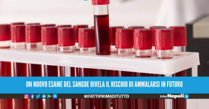 Un nuovo esame del sangue sarà in grado di svelare l'età degli organi.