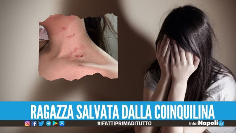 Strangolata e picchiata dal fidanzato, la 18enne scappa a Mugnano