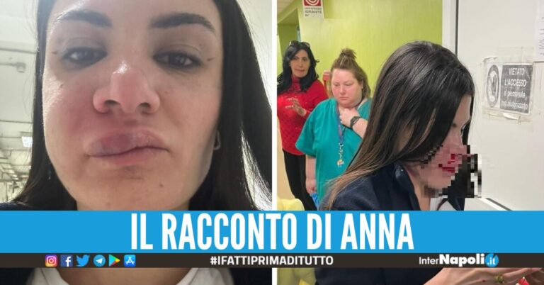 L’infermiera presa a pugni all’ospedale di Castellammare: “Mi ha pestato perché donna”